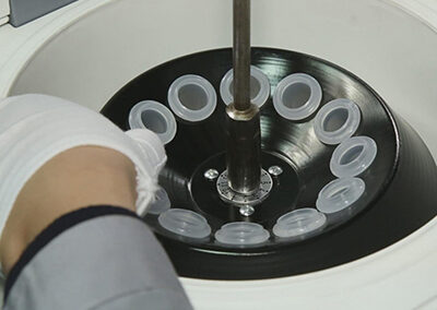 About 7 Centrifuge assembly